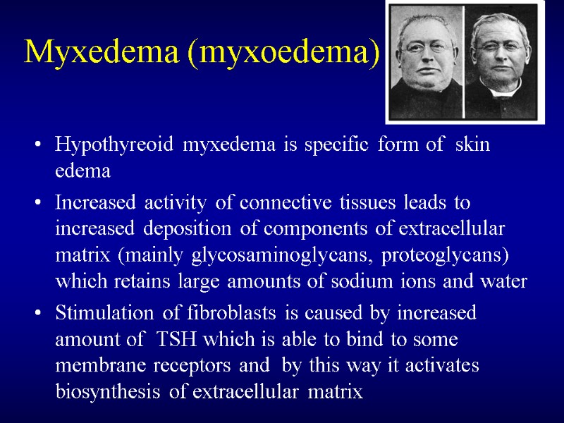 Myxedema (myxoedema) Hypothyreoid myxedema is specific form of  skin edema Increased activity of